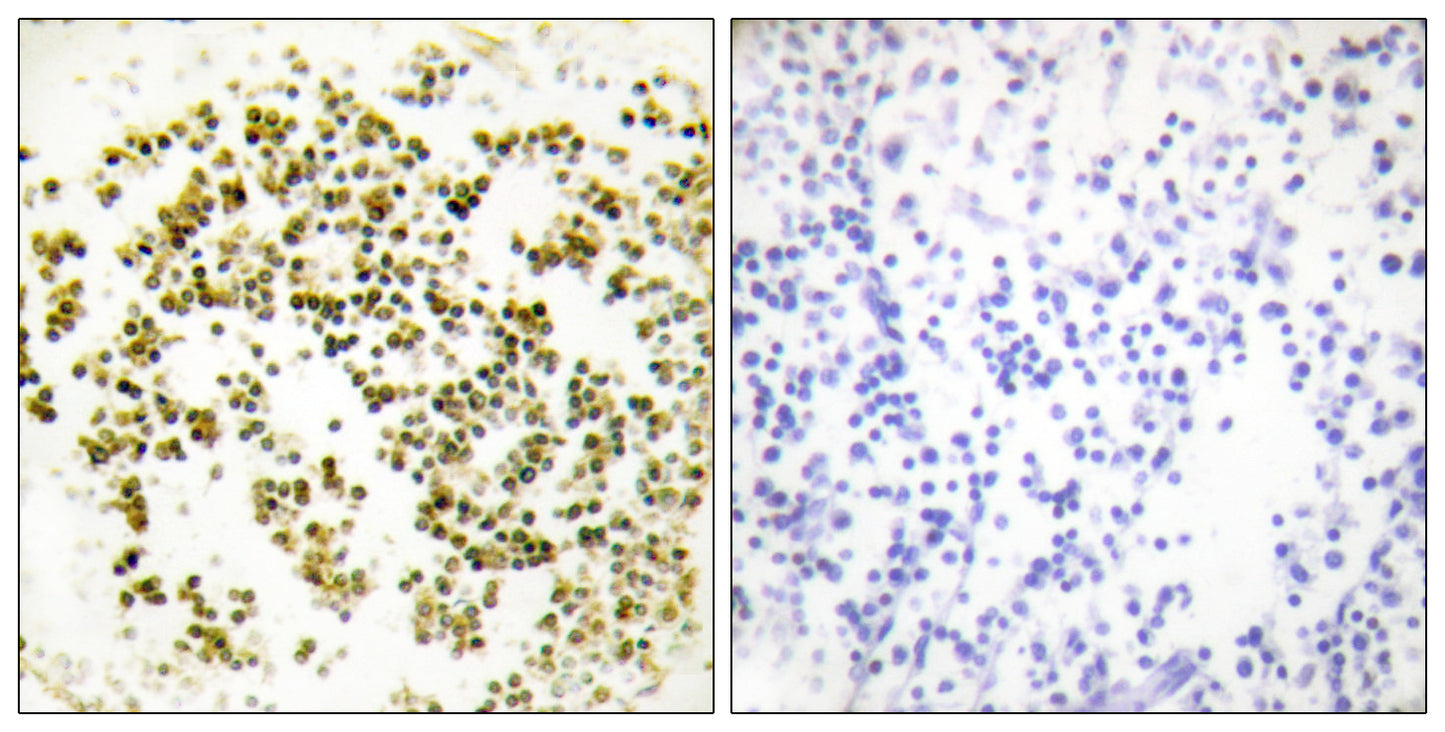 Musculin Rabbit Polyclonal Antibody