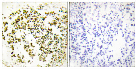 Musculin Rabbit Polyclonal Antibody