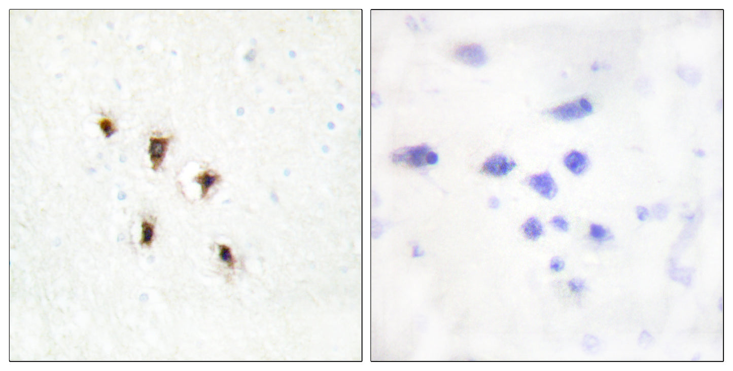 MVK Rabbit Polyclonal Antibody