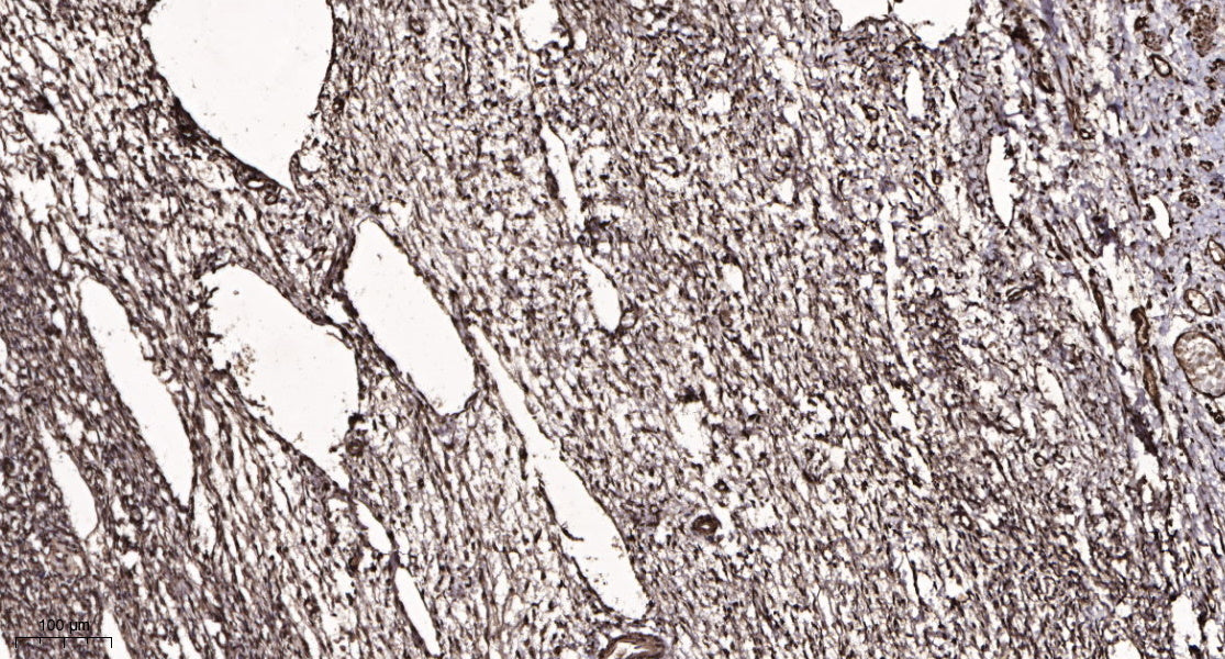 MYCNOS Rabbit Polyclonal Antibody