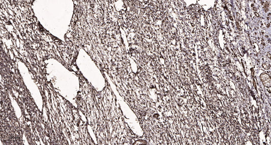 MYCNOS Rabbit Polyclonal Antibody