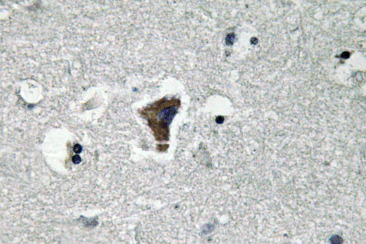 MyD88 Rabbit Polyclonal Antibody