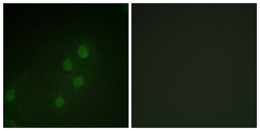 Myf-5 Rabbit Polyclonal Antibody