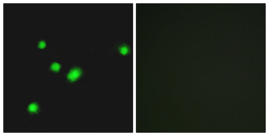 MYH Rabbit Polyclonal Antibody
