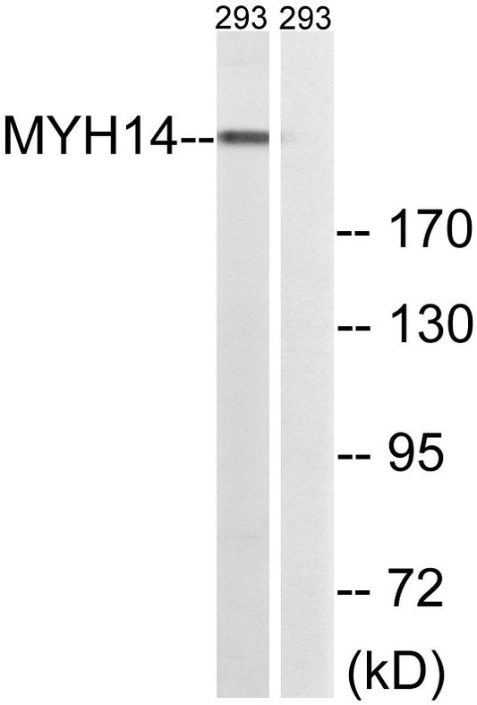MYH14 Rabbit Polyclonal Antibody