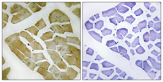 MYH4 Rabbit Polyclonal Antibody