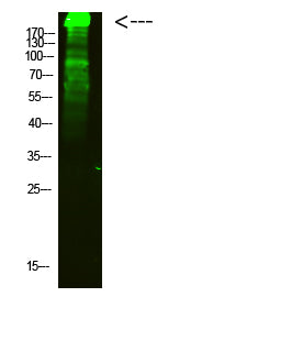 MYH6 Rabbit Polyclonal Antibody