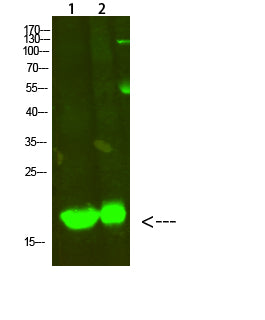 MYL2 Rabbit Polyclonal Antibody