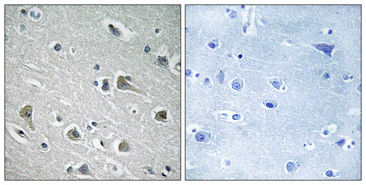 MYLIP Rabbit Polyclonal Antibody