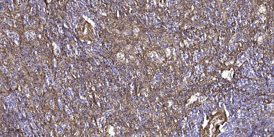 MYO15 Rabbit Polyclonal Antibody