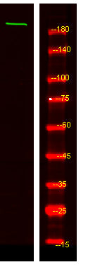 MYO5C Rabbit Polyclonal Antibody