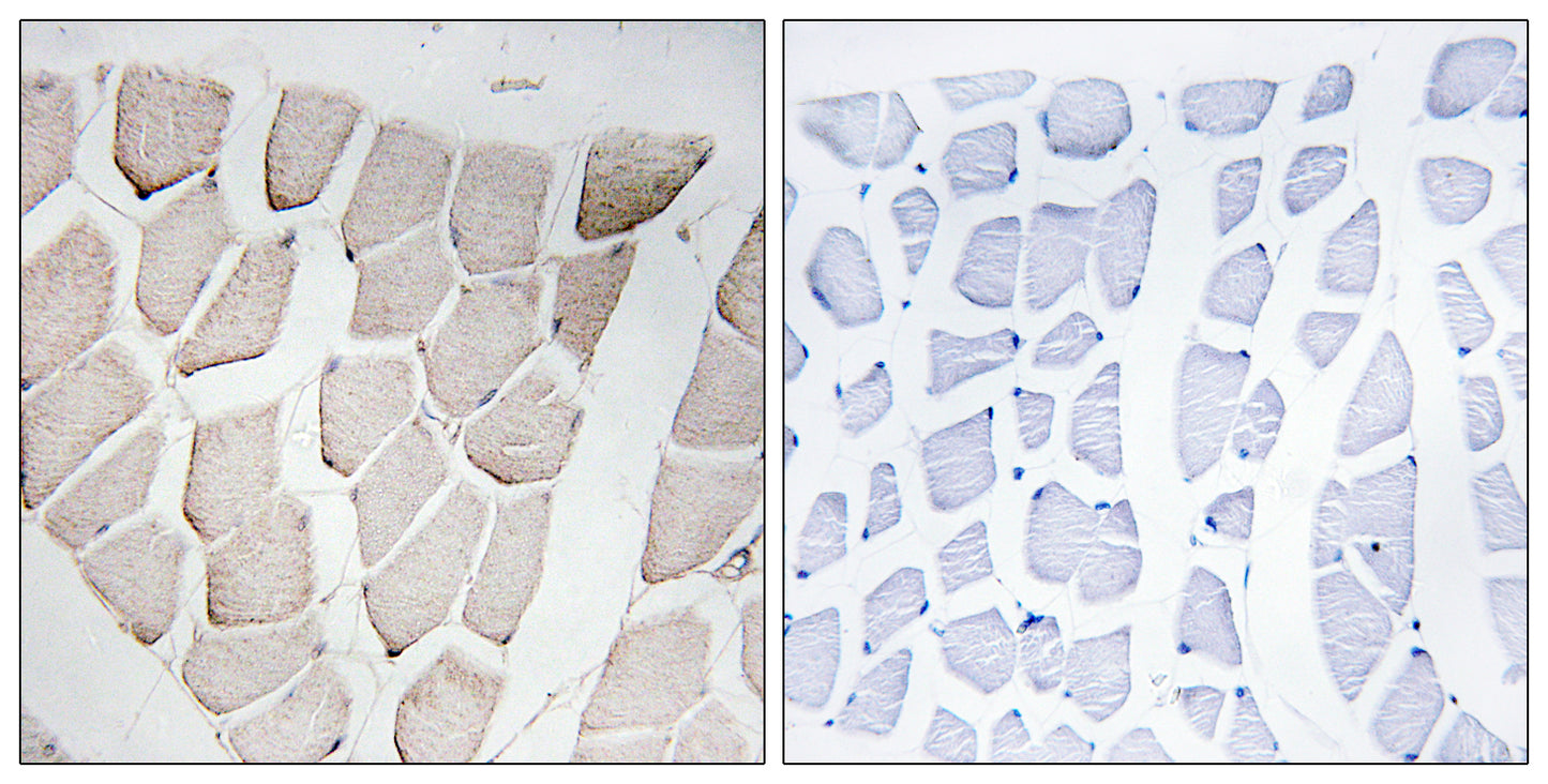 Myomesin-1 Rabbit Polyclonal Antibody