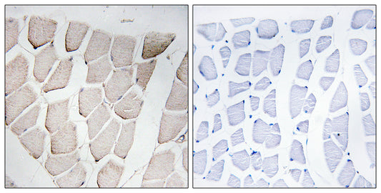 Myomesin-1 Rabbit Polyclonal Antibody