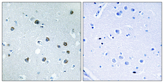 Myosin Id Rabbit Polyclonal Antibody