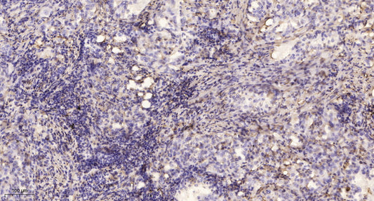 Myosin VA Rabbit Polyclonal Antibody