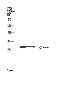 MYOZ2 Rabbit Polyclonal Antibody