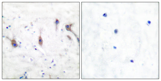 Myp Rabbit Polyclonal Antibody