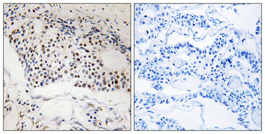 MYSM1 Rabbit Polyclonal Antibody