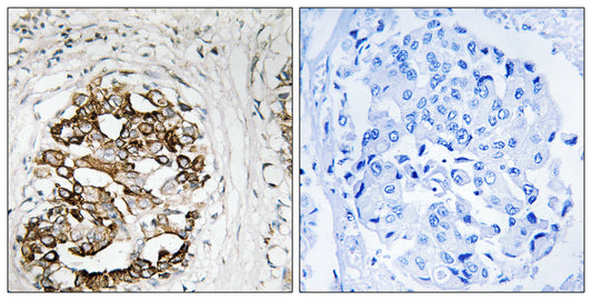 Myt 1 Rabbit Polyclonal Antibody
