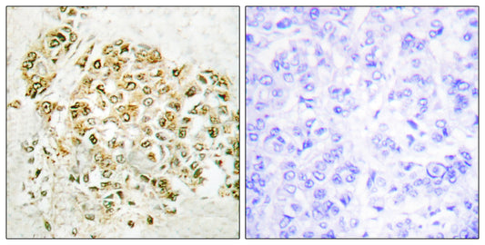 MZF-1 Rabbit Polyclonal Antibody