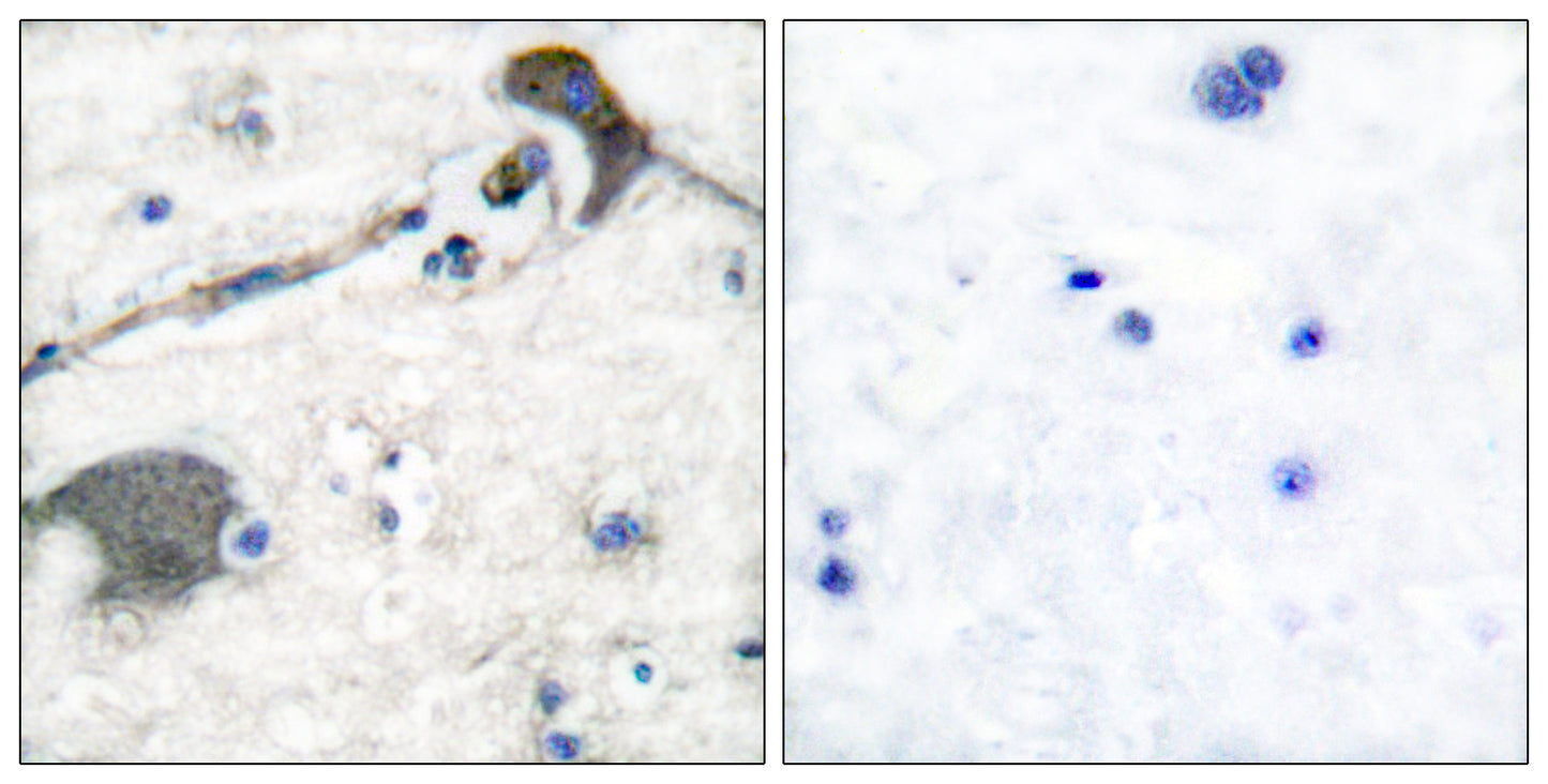 N/H/K-Ras Rabbit Polyclonal Antibody