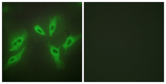 N33 Rabbit Polyclonal Antibody