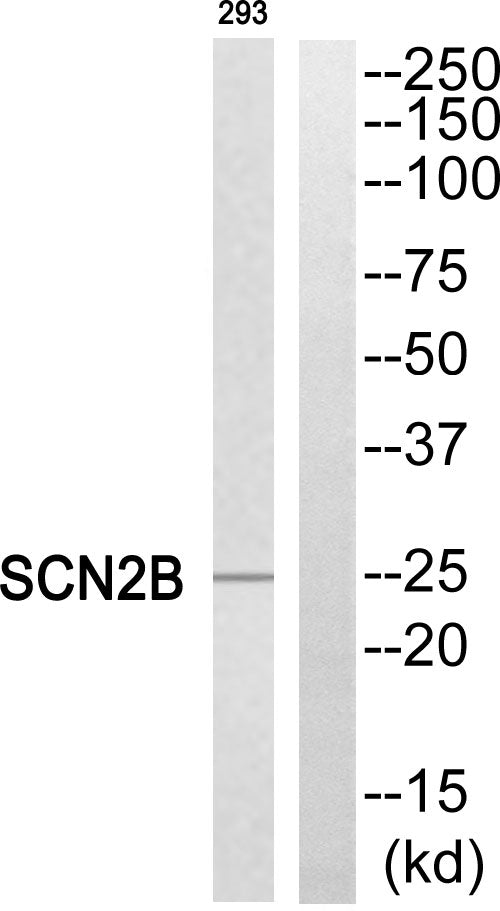 Na+ CP type IIβ Rabbit Polyclonal Antibody