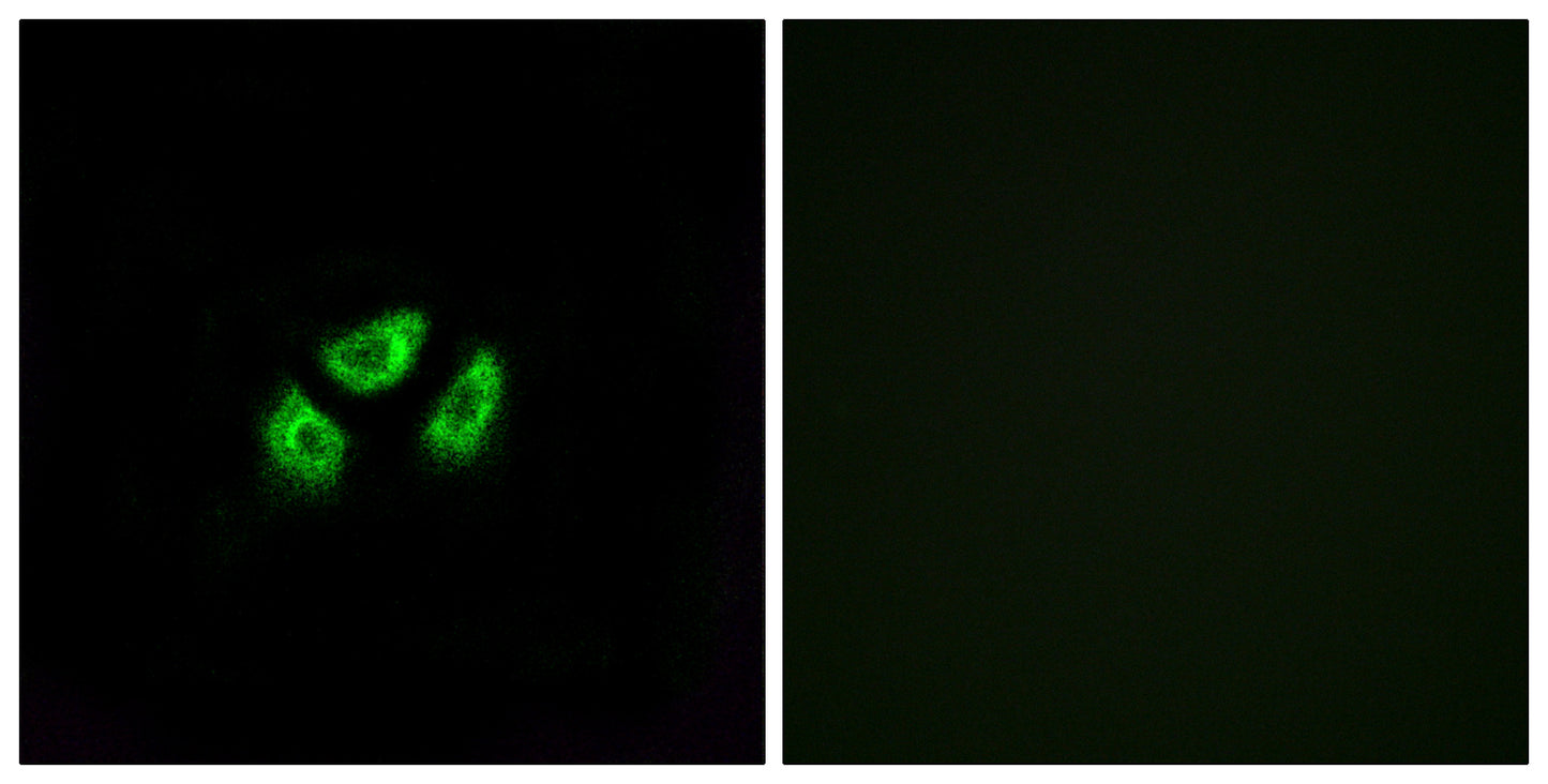 Na+ CP type VIIα Rabbit Polyclonal Antibody
