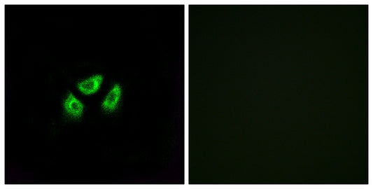 Na+ CP type VIIα Rabbit Polyclonal Antibody