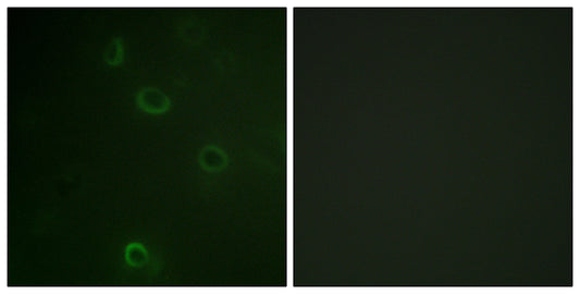 Na+/K+-ATPase α1 Rabbit Polyclonal Antibody