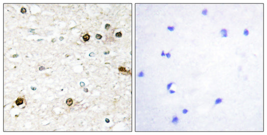 NAB2 Rabbit Polyclonal Antibody