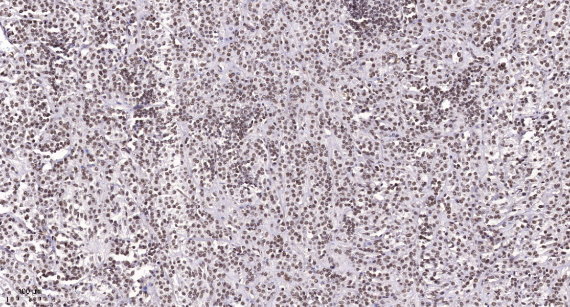 NAV3 Rabbit Polyclonal Antibody
