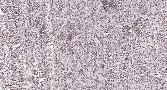 NAV3 Rabbit Polyclonal Antibody