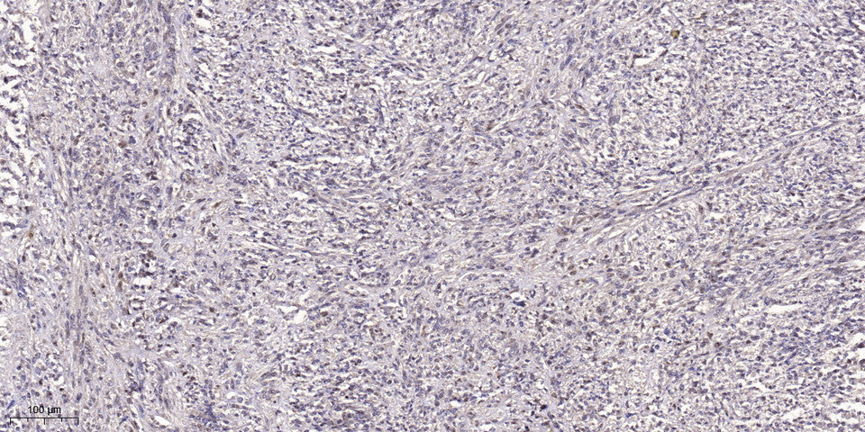 NBAS Rabbit Polyclonal Antibody