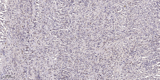 NBAS Rabbit Polyclonal Antibody