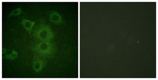 NBK Rabbit Polyclonal Antibody