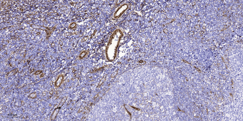 NBPF4 Rabbit Polyclonal Antibody
