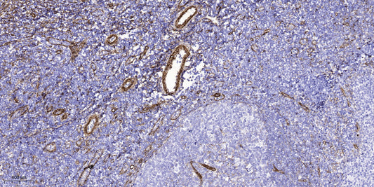 NBPF4 Rabbit Polyclonal Antibody