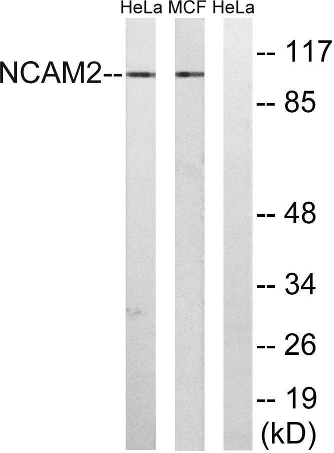 NCAM2 Rabbit Polyclonal Antibody