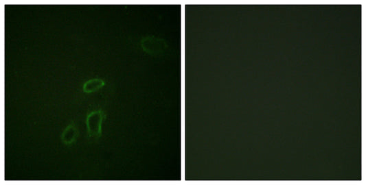 NCAM-L1 Rabbit Polyclonal Antibody