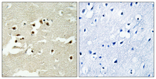 NCoA-5 Rabbit Polyclonal Antibody