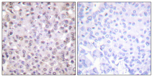 N-CoR Rabbit Polyclonal Antibody