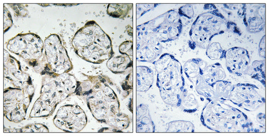 ND1 Rabbit Polyclonal Antibody