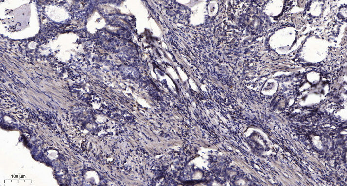 NDUFA1 Rabbit Polyclonal Antibody