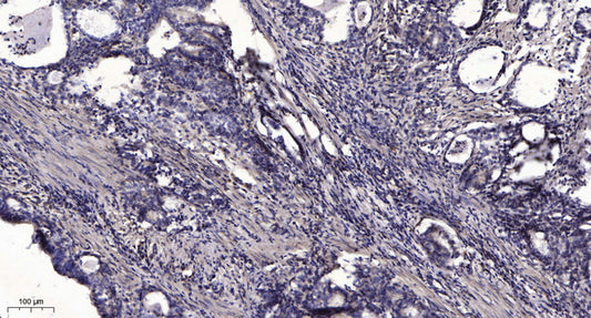 NDUFA1 Rabbit Polyclonal Antibody