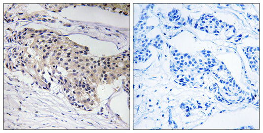 NDUFA3 Rabbit Polyclonal Antibody