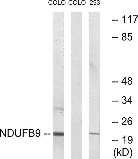 NDUFB9 Rabbit Polyclonal Antibody
