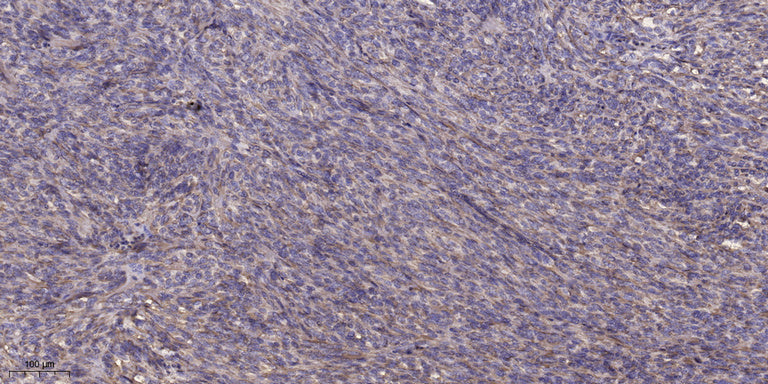 NDUFC1 Rabbit Polyclonal Antibody