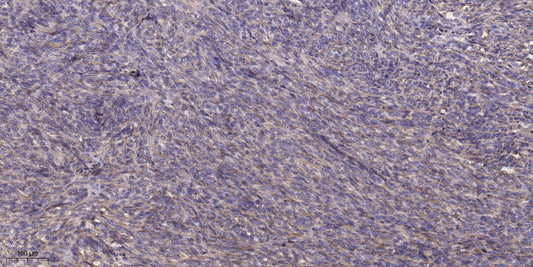 NDUFC1 Rabbit Polyclonal Antibody