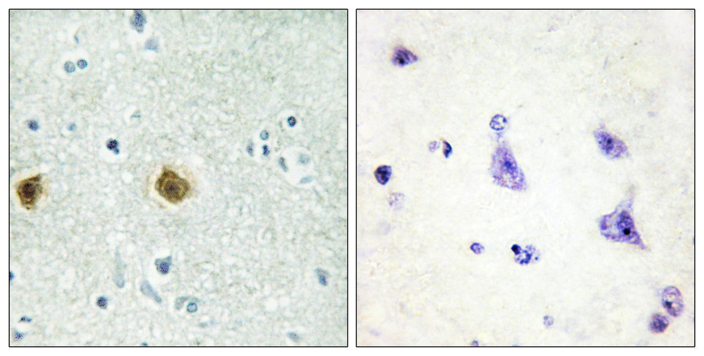 NDUFC2 Rabbit Polyclonal Antibody
